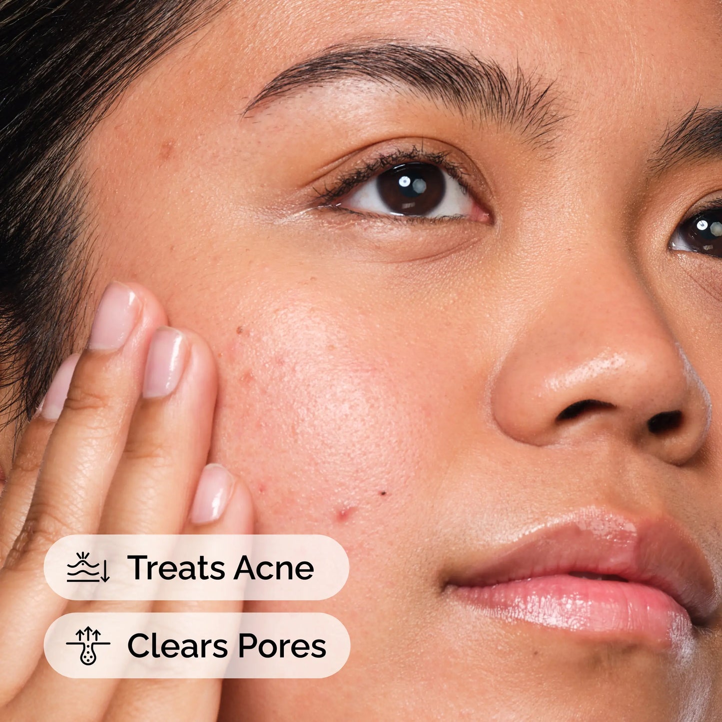 The Ordinary Salicylic Acid 2% Solution, Acne-Fighting Serum for Blemish-Prone Skin, 1 Fl Oz
