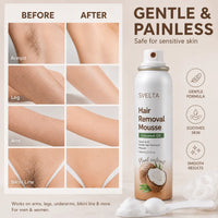 SVELTA Korean Bikini Hair Removal Cream Mousse, Arms & Underarms,Back to School