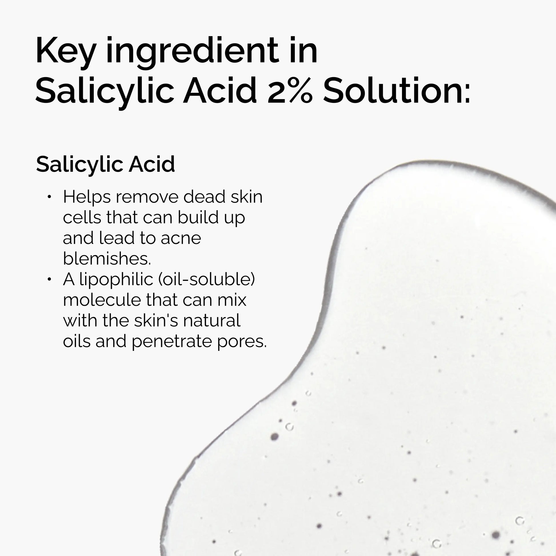 The Ordinary Salicylic Acid 2% Solution, Acne-Fighting Serum for Blemish-Prone Skin, 1 Fl Oz