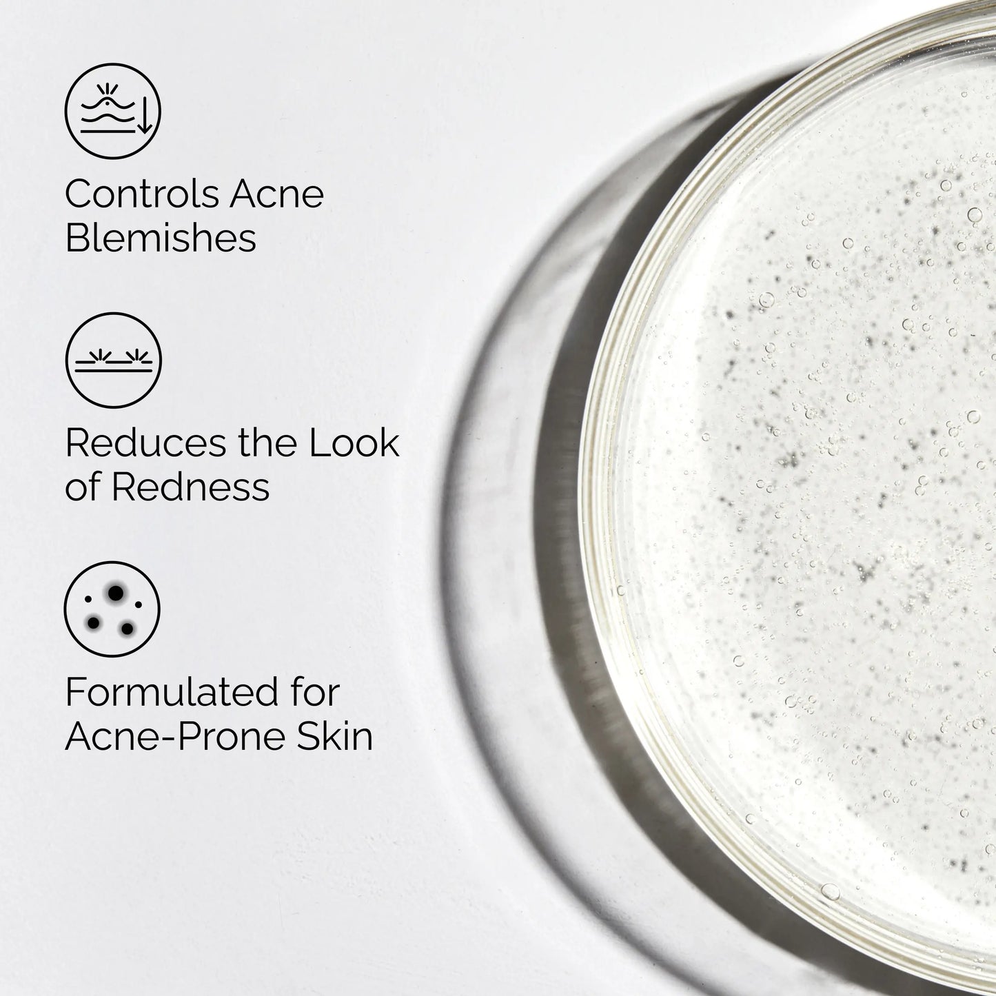 The Ordinary Salicylic Acid 2% Solution, Acne-Fighting Serum for Blemish-Prone Skin, 1 Fl Oz