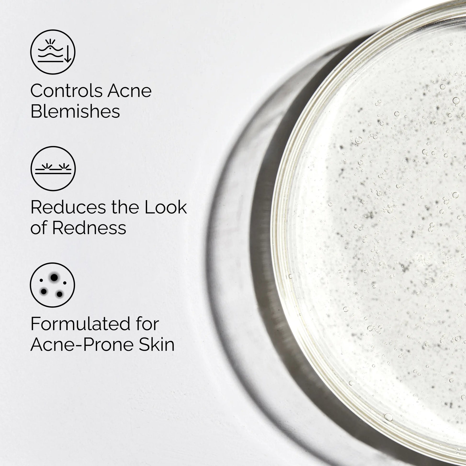 The Ordinary Salicylic Acid 2% Solution, Acne-Fighting Serum for Blemish-Prone Skin, 1 Fl Oz